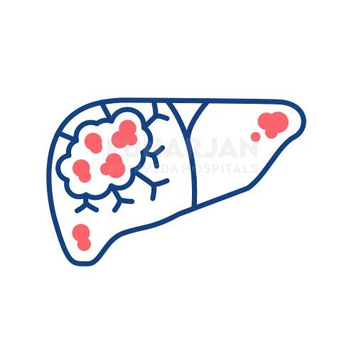 Best Liver Cancer Treatment Hospitals in Chennai