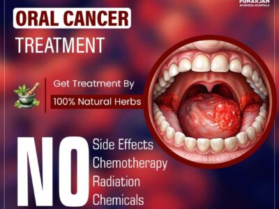 Best Oral Cancer Treatment Hospitals in Chennai
