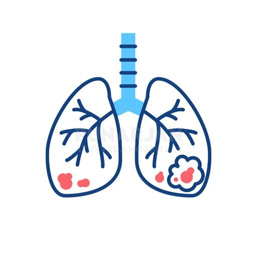 Best lung cancer Treatment hospitals in Hyderabad