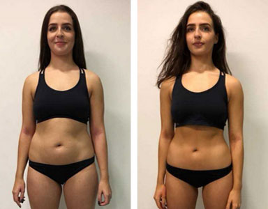 Supra Keto BHB ACV Gummies | Boost Ketosis & Weight Loss Naturally