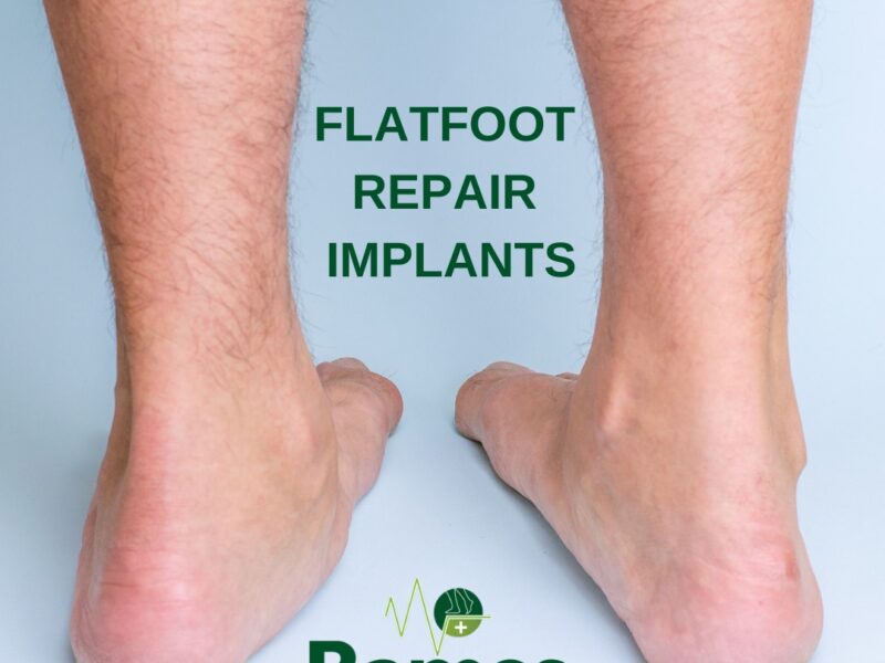 Treatment For Flat Feet Woodbridge