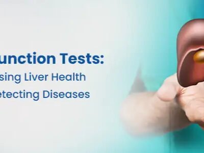 Liver Function Test in Hyderabad | Accurate LFT Testing at Sprint Diagnostics